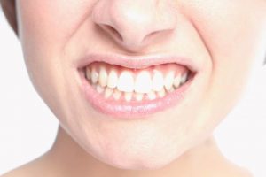 Rechinar dientes - Bruxismo - Odontología