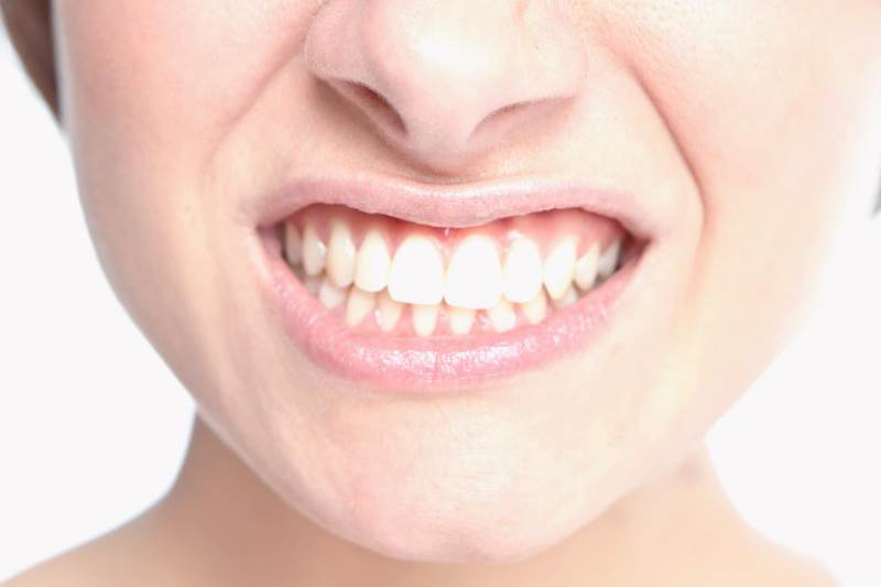 Rechinar dientes - Bruxismo - Odontología