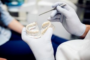 coronas dentales odontologos quito estetica dental