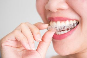 blanqueamiento dientes amarillos