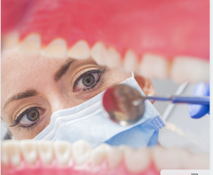 Estetica Dental, Diseño de Sonrisa, Blanqueamiento Dental, Odontología