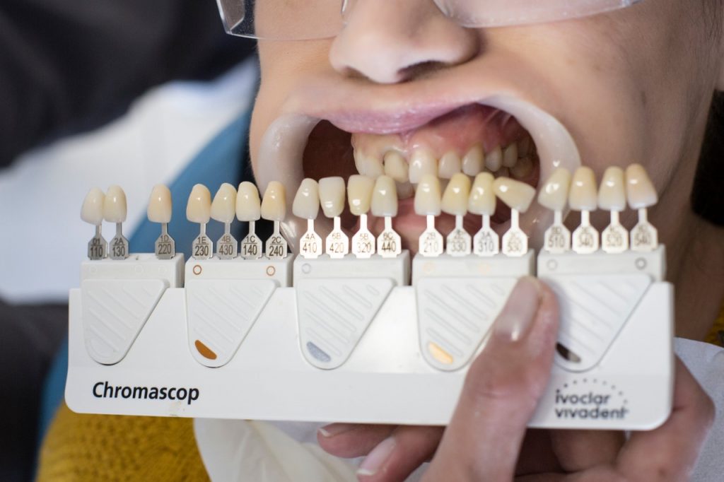 Estetica Dental, Diseño de Sonrisa, Blanqueamiento Dental, Odontología